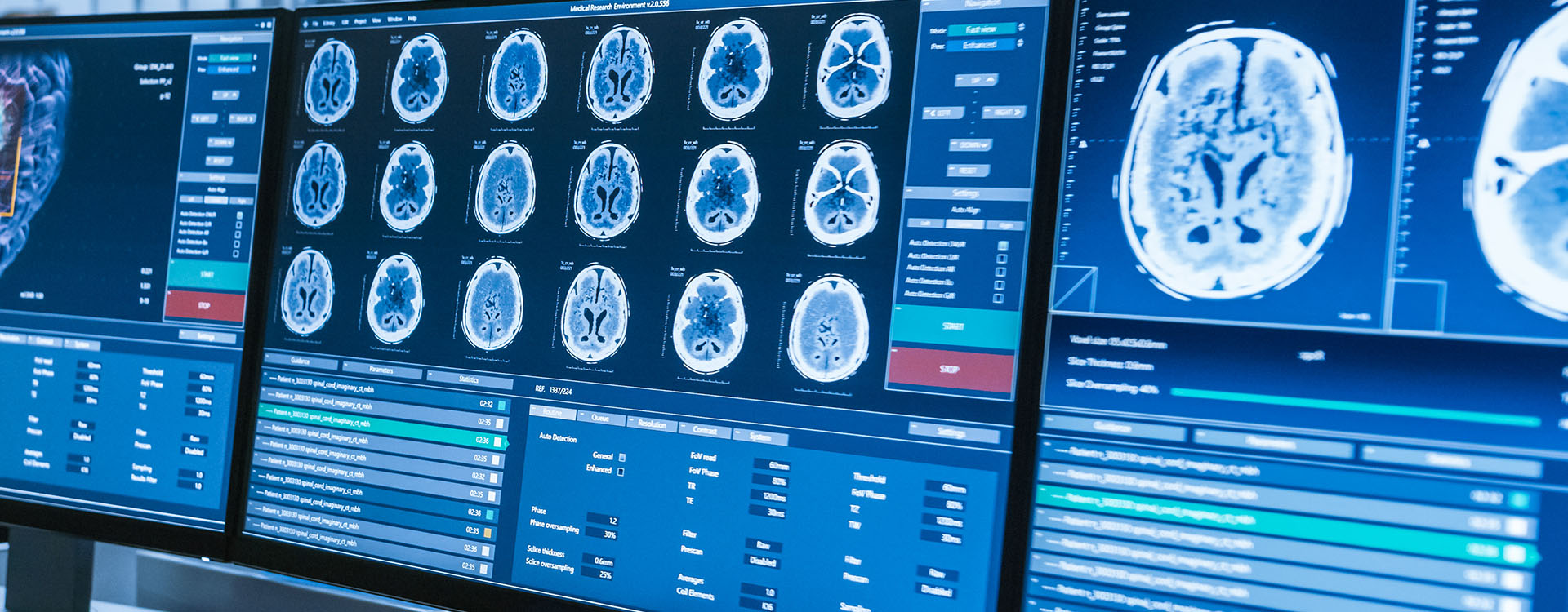 Computer monitors showing results of medical test